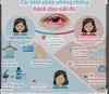 Các biện pháp phòng chống bệnh đau mắt đỏ